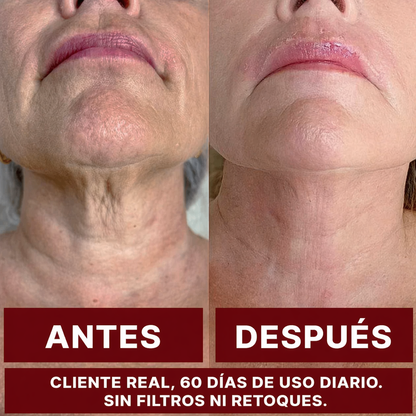 ZOOONE NAD+ Líquido | Absorción inmediata